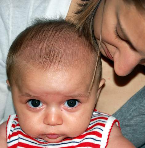 My cheeks are so fat it hurts to smile!