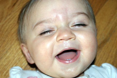 Is that a bruise on my forehead?